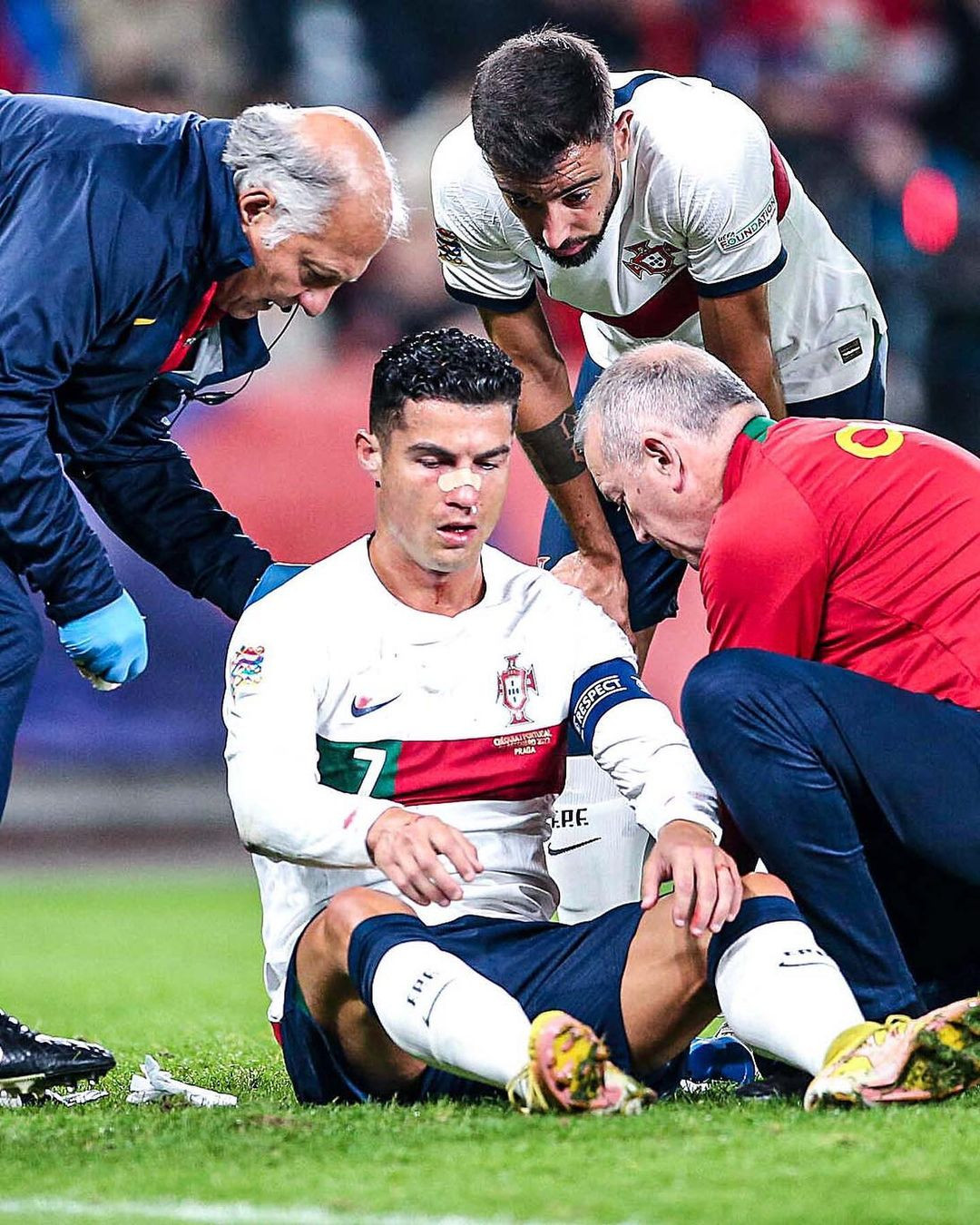 Xót xa hình ảnh Ronaldo đổ máu sau cú đấm thẳng mặt của thủ môn CH Séc